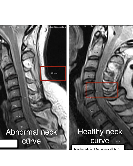 Kang Corrective Chiropractic P.C. Picture 10