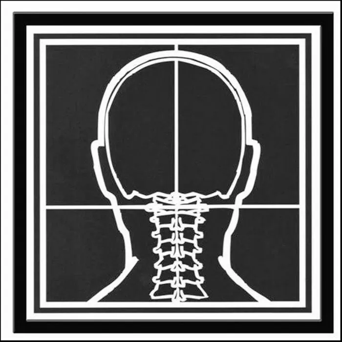 AO (At-las Or-thog-o-nal) Picture 2