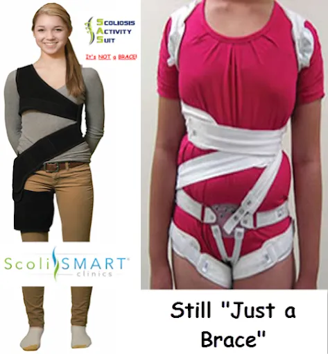 ScoliSmart - Scoliosis Treatments Picture 3