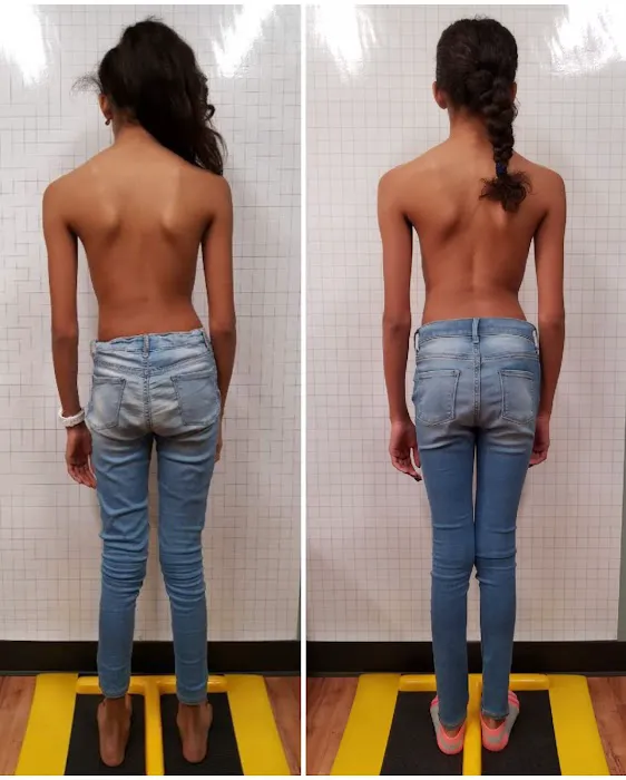 Advanced Chiropractic & Scoliosis Center - Dr. Paul Kang, BS., D.C., CCEP Picture 4
