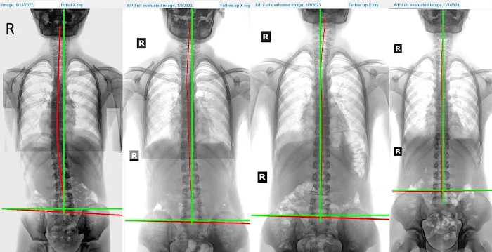 ADIO Corrective Chiropractic Picture 10
