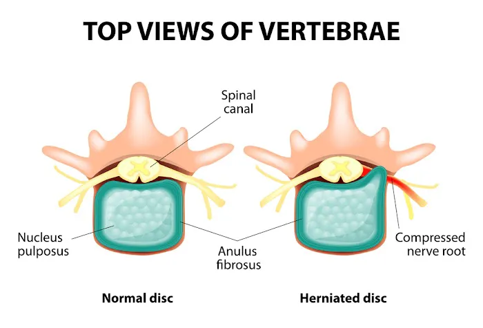 Liberty Chiropractic & Physical Therapy Picture 1