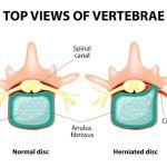 Liberty Chiropractic & Physical Therapy