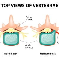 Liberty Chiropractic & Physical Therapy ico