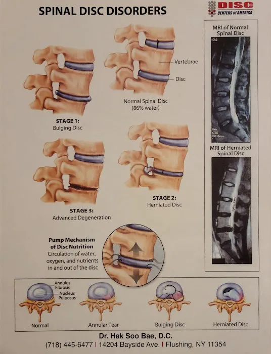Bae Chiropractic, P.C. - Queens Disc Center Picture 10