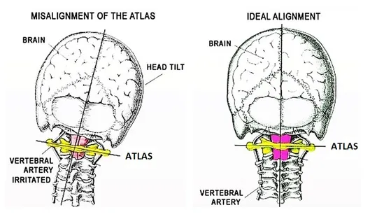 Dr. Gary Golembiewski | Atlas Orthogonal Chiropractor of Park Ridge for Neck & Back Pain, Migraine Headaches & More Picture 2