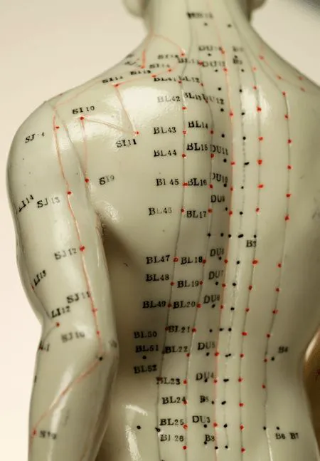 Nguyen Chiropractic and Acupuncture Wellness Picture 9