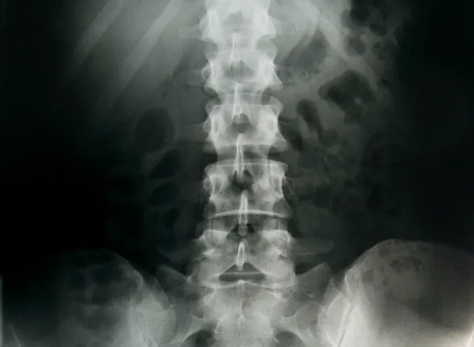 Dr. Stephen M. Perlman Picture 3