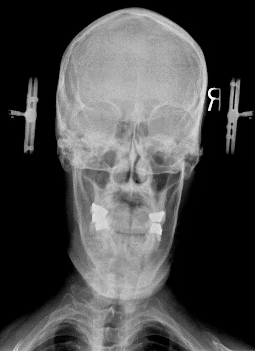 Atlas Orthogonal Chiropractic, LLC Picture 2