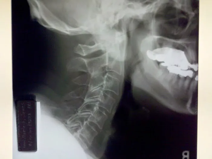 Atlas Orthogonal Chiropractic, LLC Picture 6
