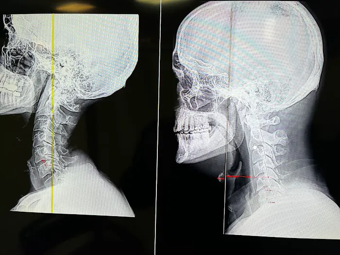 Suffern Chiropractic Picture 2