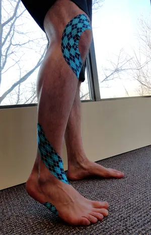 Bean Sports Medicine Picture 1