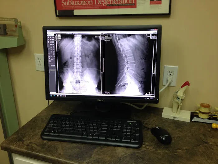 Ozone Park Chiropractic Picture 5