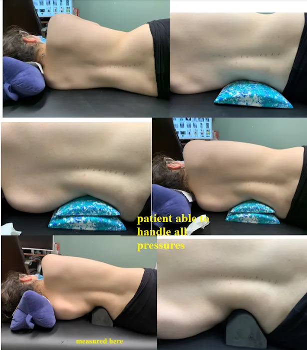 New York Chiropractic & Scoliosis Center Picture 9