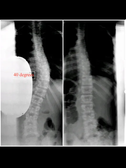 New York Chiropractic & Scoliosis Center Picture 8