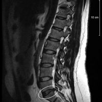 Dr. Joseph D. Salamone, DC, DAAPM, FRCCM ico