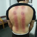 SOTO CHIROPRACTIC PLLC