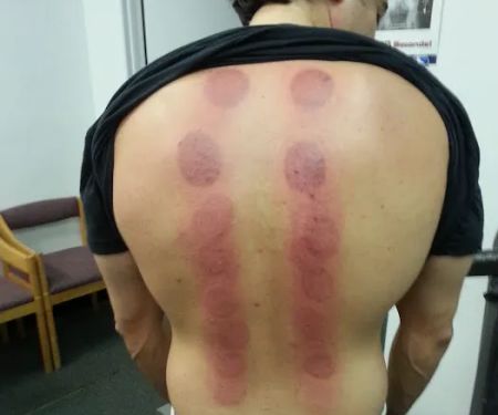 SOTO CHIROPRACTIC PLLC