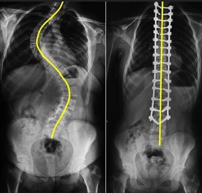 Hansen Chiropractic Picture 9