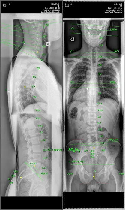 NJ Gonstead Chiropractic Picture 10