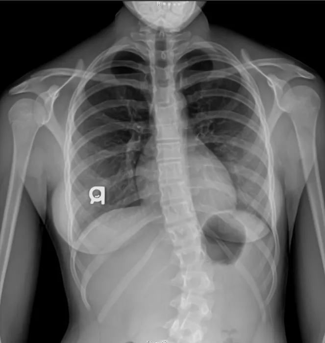 Dr. Lawrence Wood Picture 9