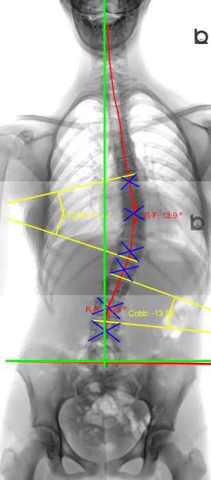 Community Chiropractic Center Picture 10