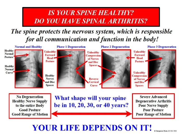Chiropractic Works: Brian Solofsky, DC Picture 2