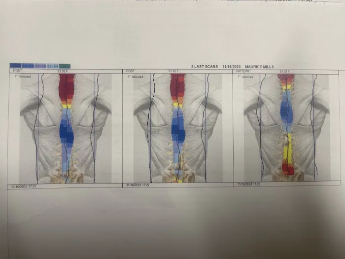 Burlington Chiropractic Picture 6