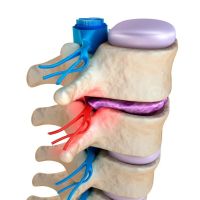 NJ Nerve Chiropractic & Laser ico