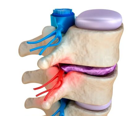 NJ Nerve Chiropractic & Laser