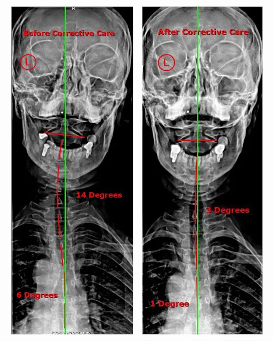 Align Chiropractic Picture 9