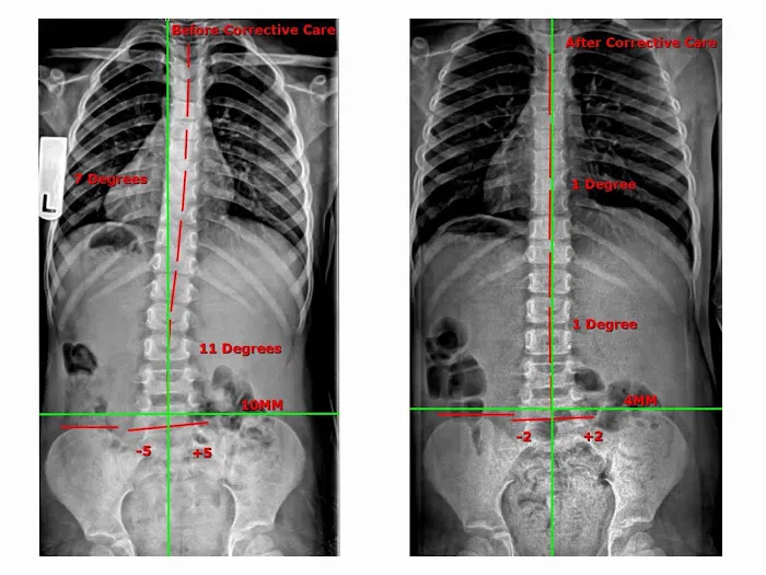 Align Chiropractic Picture 7