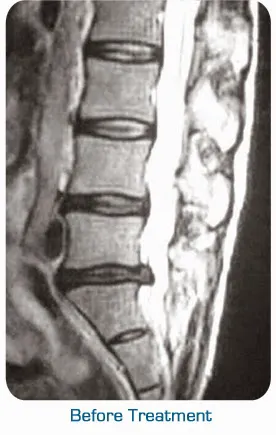 Dr. James T. Murphy DC, BSN Chiropractor 5th Street Spine Picture 4