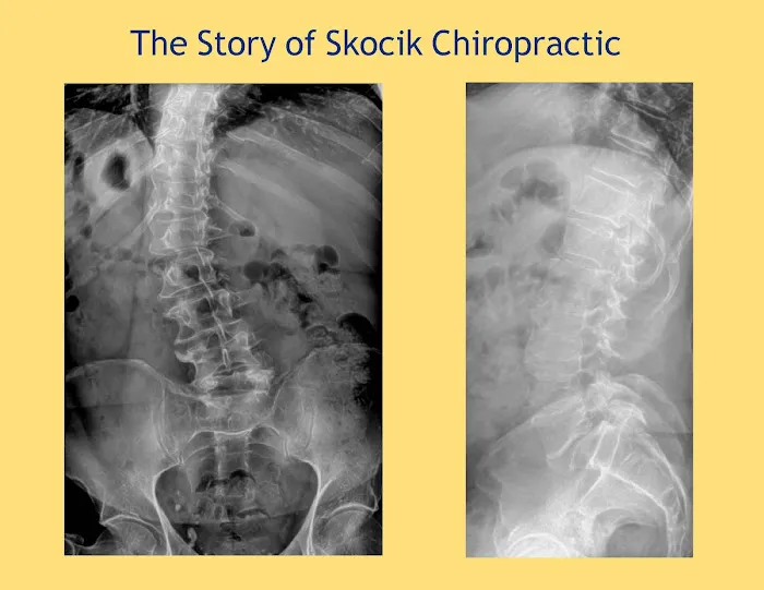 Albert Skocik, DC Picture 8