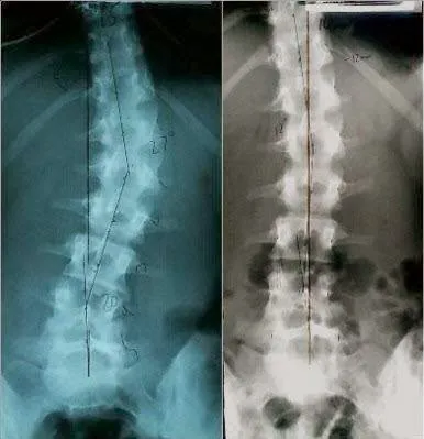 Central PA Spinal Health Chiropractic, LLC Picture 8