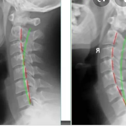 Chiropractor John Pandolfo, DC Picture 10
