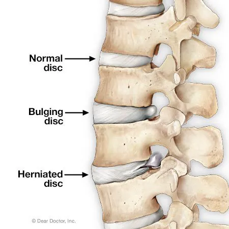 Active Family Chiropractic Picture 9