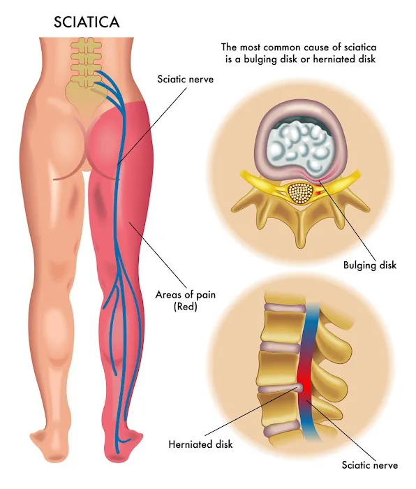 Active Family Chiropractic Picture 8
