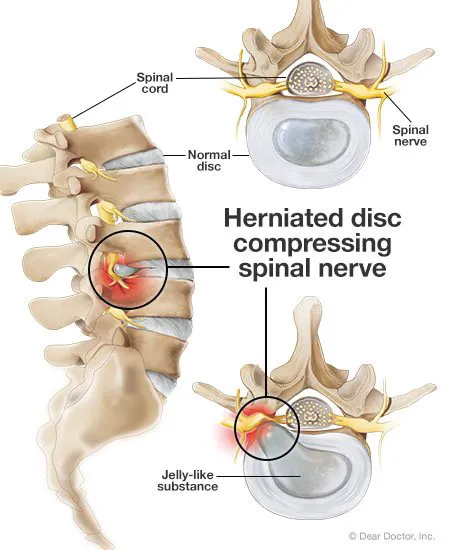 Active Family Chiropractic Picture 10