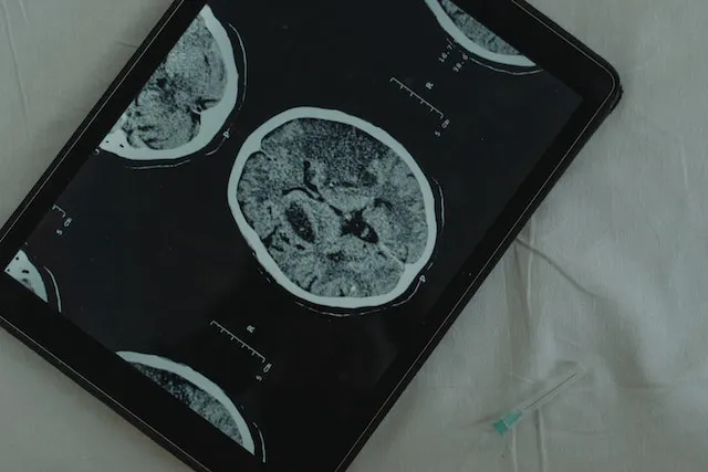 Hope Brain & Body Recovery Center Picture 9