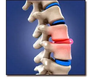 Chiropractor Wilmington Picture 1