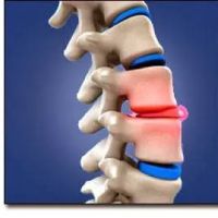 Chiropractor Wilmington ico