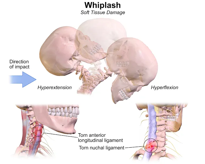 Meade Chiropractic Picture 9