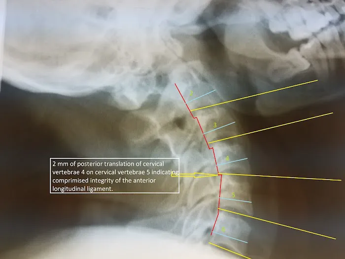 Accident Care & Wellness Center of Cincinnati (Norwood) Picture 9