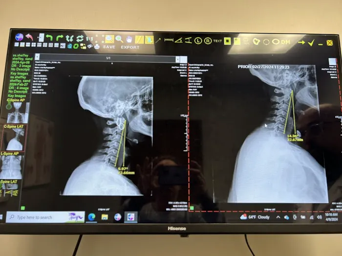 Rauch Chiropractic & Rehab Picture 1