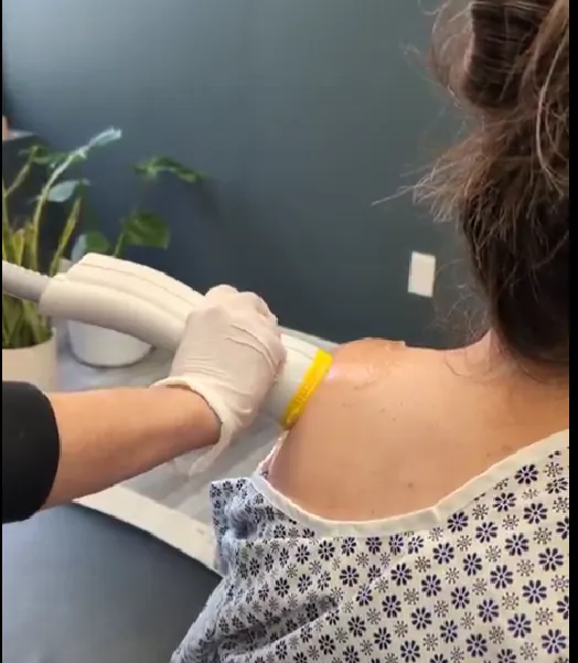 SoftWave Therapy Cincinnati Picture 1