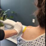 SoftWave Therapy Cincinnati