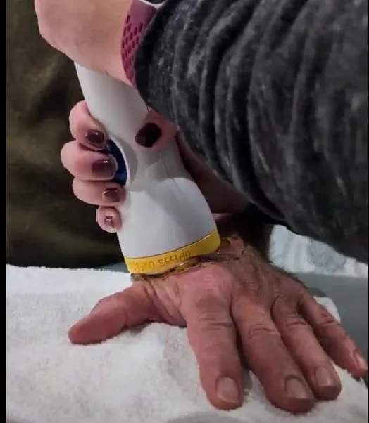SoftWave Therapy Cincinnati Picture 7