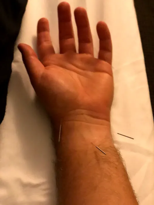 Dalton Wood, DC Picture 6