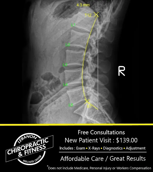 Lebanon Chiropractic & Fitness Picture 5